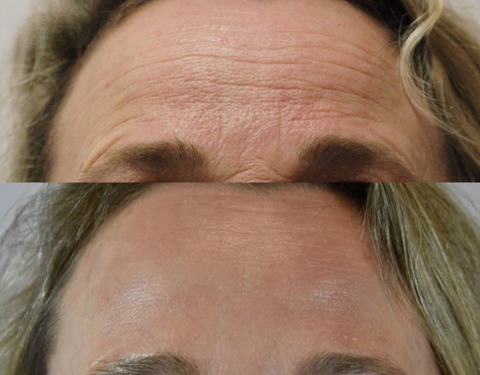 Ageless Radiance Collagen Boost Set