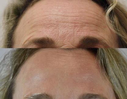 Ageless Radiance Collagen Boost Set