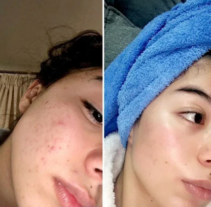 Ageless Radiance Collagen Boost Set